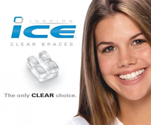 Invisible Orthodontics - Implantcenter dentistry UK